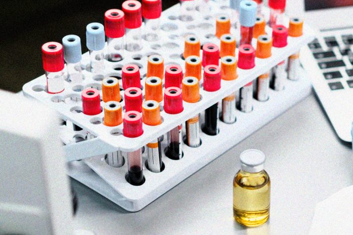 NXP, GE HealthCare Partner to Advance Edge AI for Acute Care at CES 2026